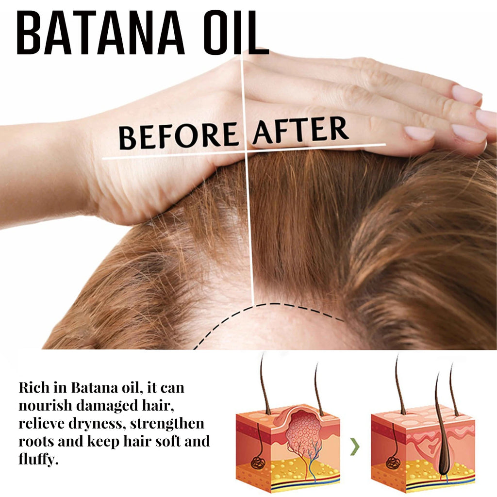 Natural Batana Oil Hair Spray anti Hair Loss Hair Care Promotes Hair Growth Suitable for Men and Women Hair Conditioner