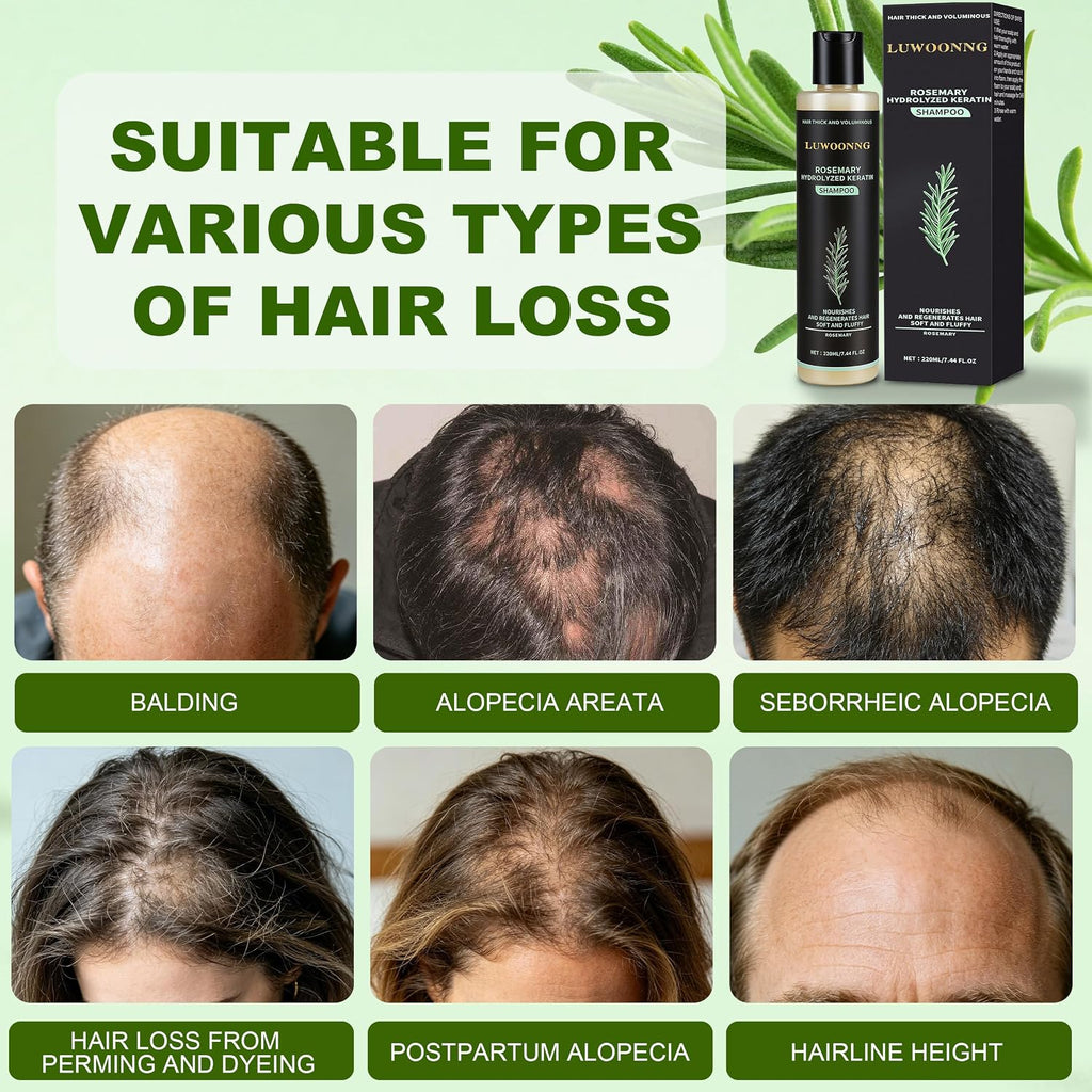 Rosemary Shampoo, Hair Growth Shampoo with Hydrolyzed Keratin, Nourishes Repairs Dry Damaged Thinning Hair, Unisex