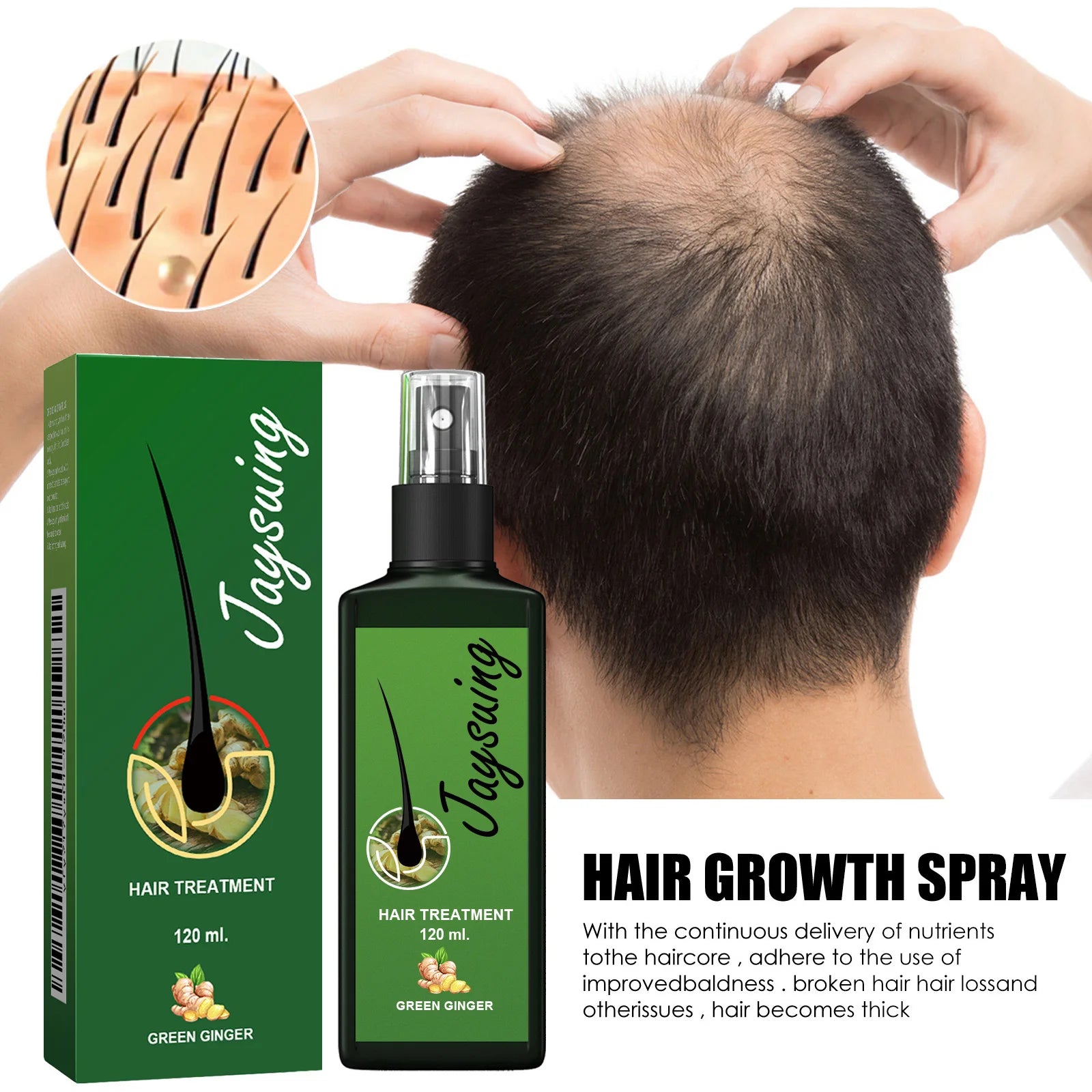 Hair Growth Spray Ginger Massage Scalp Damaged Treatment Solution Nourish Roots Fast Grow anti Hair Loss Serum Beauty Health
